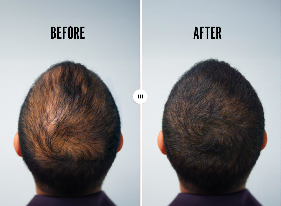 REVIVOGEN MD BIO-CLEANSING SHAMPOO & THICKENING CONDITIONER KIT