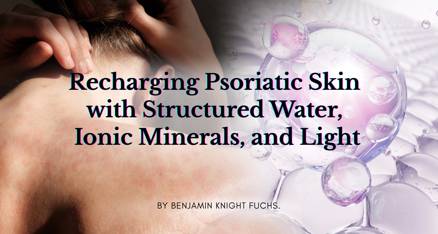 How Light, Minerals & Structured Water Help Calm Psoriatic Skin.