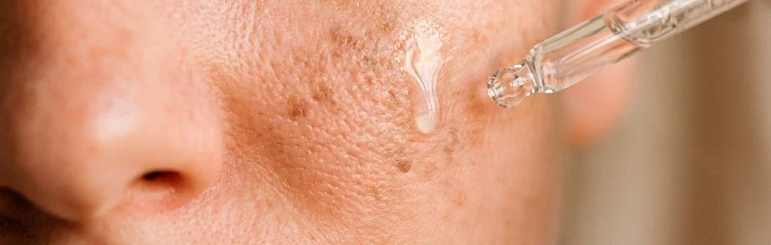 What Is a Vitamin C Serum?
